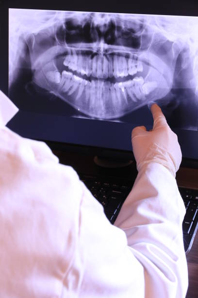 Best Emergency Treatment for Dental Infections or Abscesses in Redfield, SD