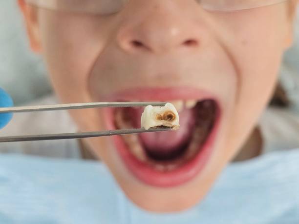 Best Pediatric Emergency Dentist in Redfield, SD